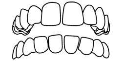 Gapped Teeth